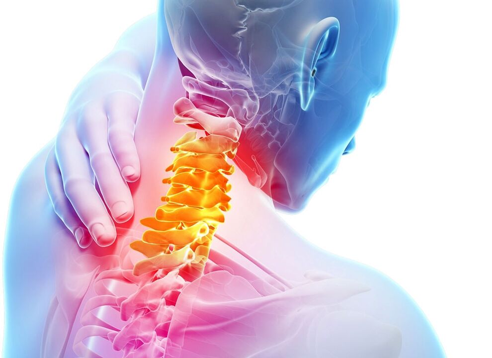 Symptomer vun cervical osteochondrosis